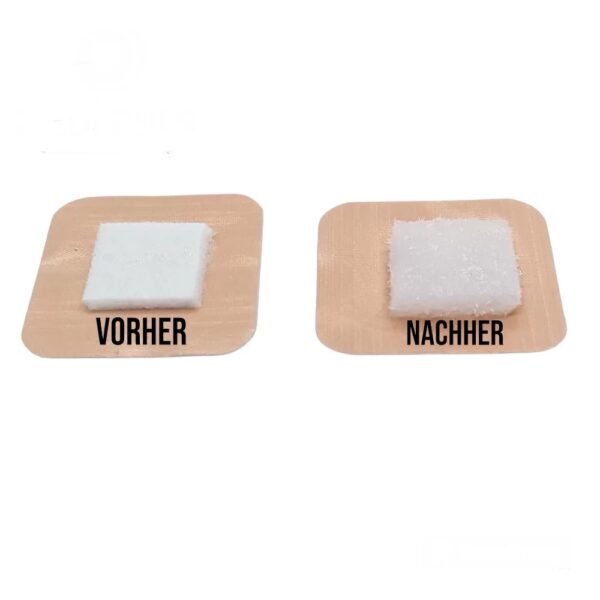 Blutegel Pflaster 10er Pack – Bild 2