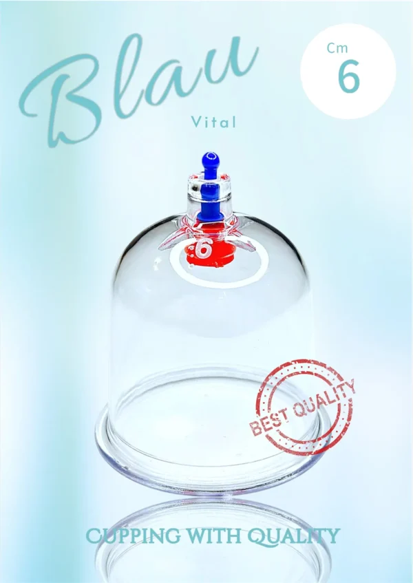 Schröpfglas
